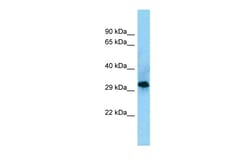Aviva Systems Biology Corp CD86 Antibody - C-terminal region (ARP63006_P050)
