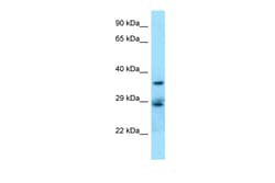Aviva Systems Biology Corp CD68 Antibody - middle region (ARP63008_P050)