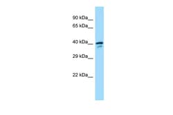 Aviva Systems Biology Corp Sms Antibody - middle region (ARP63041_P050)
