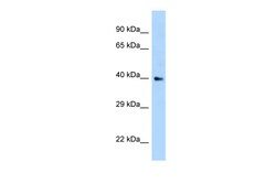 Aviva Systems Biology Corp AIDA Antibody - N-terminal region (ARP63070_P050)