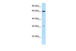 Aviva Systems Biology Corp OSCAR Antibody - C-terminal region (ARP63084_P050)