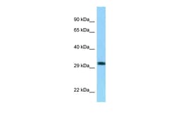 Aviva Systems Biology Corp RHD Antibody - C-terminal region (ARP63085_P050)