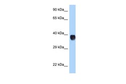 Aviva Systems Biology Corp RHD Antibody - N-terminal region (ARP63086_P050)