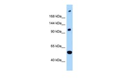 Aviva Systems Biology Corp L1CAM Antibody - C-terminal region (ARP63103_P050)