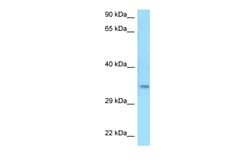 Aviva Systems Biology Corp C9orf30 Antibody - C-terminal region (ARP63119_P050)
