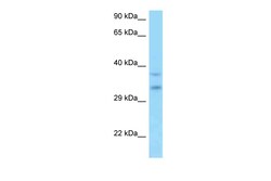 Aviva Systems Biology Corp C9orf30 Antibody - middle region (ARP63120_P050)