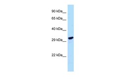 Aviva Systems Biology Corp LDHAL6A Antibody - C-terminal region (ARP63123_P050)