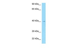 Aviva Systems Biology Corp AADACL3 Antibody - N-terminal region (ARP63127_P050)