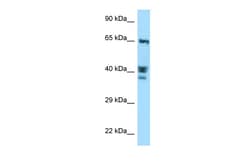 Aviva Systems Biology Corp ACTL8 Antibody - C-terminal region (ARP63129_P050)