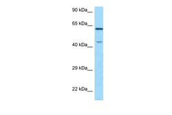 Aviva Systems Biology Corp ARMCX5 Antibody - C-terminal region (ARP63143_P050)