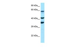 Aviva Systems Biology Corp SPARC Antibody - C-terminal region (ARP63168_P050)
