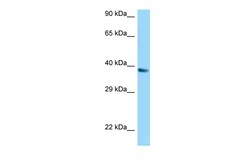 Aviva Systems Biology Corp UCP1 Antibody - C-terminal region (ARP63203_P050)