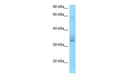 Aviva Systems Biology Corp UCP1 Antibody - N-terminal region (ARP63204_P050)