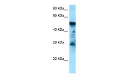 Aviva Systems Biology Corp CCKBR Antibody - C-terminal region (ARP63206_P050)