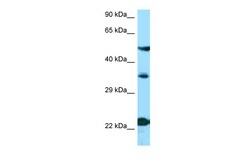 Aviva Systems Biology Corp MC4R Antibody - N-terminal region (ARP63247_P050)