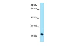 Aviva Systems Biology Corp KLRK1 Antibody - C-terminal region (ARP63274_P050)
