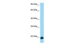 Aviva Systems Biology Corp KLRD1 Antibody - middle region (ARP63304_P050)