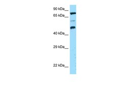Aviva Systems Biology Corp DPP4 Antibody - N-terminal region (ARP63320_P050)