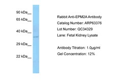 Aviva Systems Biology Corp EPM2A Antibody - N-terminal region (ARP63376_P050)