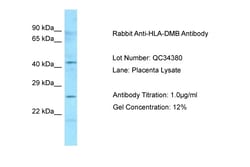 Aviva Systems Biology Corp HLA-DMB Antibody - N-terminal region (ARP63380_P050)