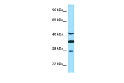 Aviva Systems Biology Corp TOR1A Antibody - C-terminal region (ARP63400_P050)