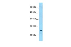 Aviva Systems Biology Corp MDK Antibody - C-terminal region (ARP63426_P050)