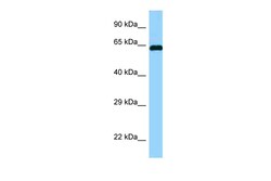 Aviva Systems Biology Corp ABI1 Antibody - N-terminal region (ARP63431_P050)