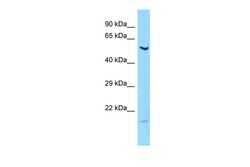 Aviva Systems Biology Corp LIPC Antibody - C-terminal region (ARP63451_P050)