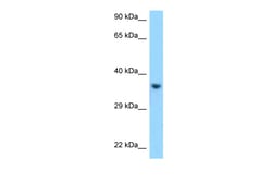 Aviva Systems Biology Corp KIR2DL1 Antibody - C-terminal region (ARP63462_P050)
