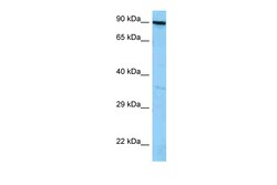 Aviva Systems Biology Corp FYB1 Antibody - C-terminal region (ARP63470_P050)