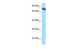 Aviva Systems Biology Corp MCAM Antibody - middle region (ARP63483_P050)