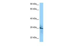 Aviva Systems Biology Corp CD151 Antibody - C-terminal region (ARP63500_P050)