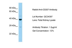Aviva Systems Biology Corp CD207 Antibody - C-terminal region (ARP63502_P050)