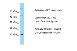 Aviva Systems Biology Corp REG1A Antibody - C-terminal region (ARP63515_P050)