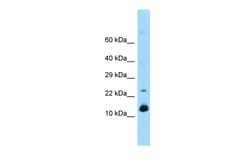 Aviva Systems Biology Corp Reg1 Antibody - middle region (ARP63516_P050)