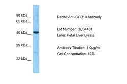 Aviva Systems Biology Corp CCR10 Antibody - middle region (ARP63519_P050)