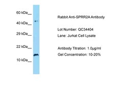 Aviva Systems Biology Corp SPRR2A Antibody - N-terminal region (ARP63530_P050)