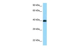 Aviva Systems Biology Corp CD72 Antibody - C-terminal region (ARP63535_P050)