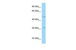 Aviva Systems Biology Corp HTRA1 Antibody - N-terminal region (ARP63548_P050)