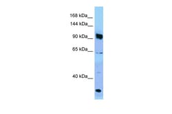 Aviva Systems Biology Corp PARG Antibody - C-terminal region (ARP63555_P050)
