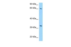 Aviva Systems Biology Corp RPS2 Antibody - N-terminal region (ARP63573_P050)