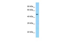 Aviva Systems Biology Corp MSR1 Antibody - N-terminal region (ARP63579_P050)