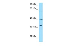 Aviva Systems Biology Corp GHSR Antibody - C-terminal region (ARP63610_P050)