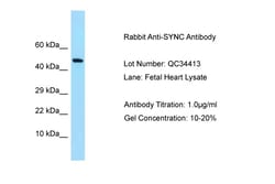 Aviva Systems Biology Corp SYNC Antibody - N-terminal region (ARP63617_P050)