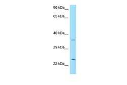 Aviva Systems Biology Corp NRTN Antibody - C-terminal region (ARP63641_P050)