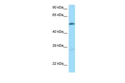 Aviva Systems Biology Corp SLC7A5 Antibody - N-terminal region (ARP63651_P050)