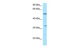 Aviva Systems Biology Corp NCR1 Antibody - C-terminal region (ARP63658_P050)