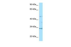 Aviva Systems Biology Corp TNFAIP6 Antibody - C-terminal region (ARP63662_P050)
