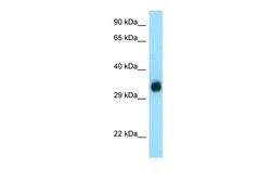 Aviva Systems Biology Corp GGH Antibody - C-terminal region (ARP63691_P050)