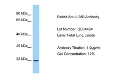 Aviva Systems Biology Corp IL28B Antibody - C-terminal region (ARP63701_P050)